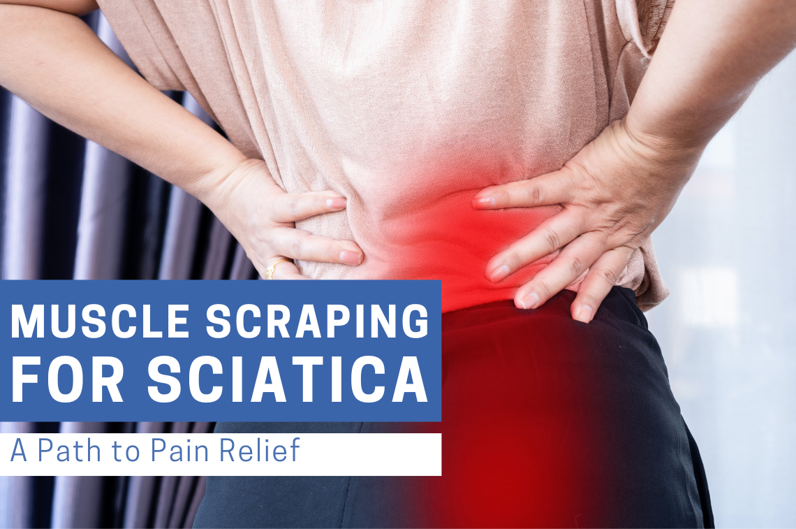 Muscle Scraping for Sciatica: A Path to Pain Relief | Bynatic